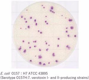 E. coli O157:H7
