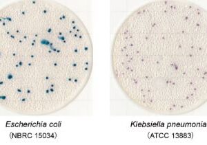 Easy-Plate-EC-E.Coli