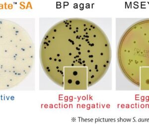 EASY-PLATE-SA- Staphylococcus aureus count.