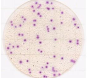 EASY-PLATE-YMR-Yeast-Mould-Rapid.